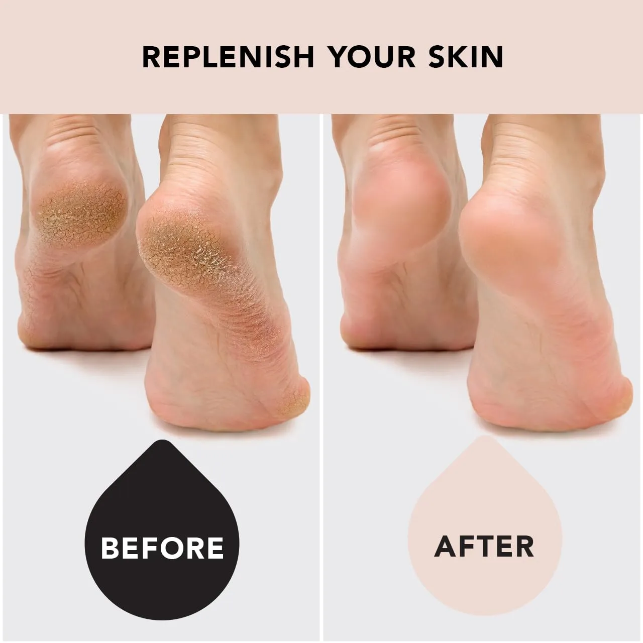 Kitsch Moisturizing Socks for Cracked Heel Treatment, Insulated Gel & Moisturizing Heel for Dry Cracked Feet Women & Men, Spa & Sleep Socks for Overnight Moisture Repair, 1 Reusable Pair