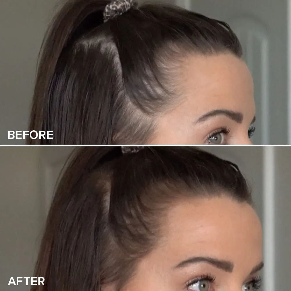 TRUHAIR Color & Conceal Waterproof Root Touch Up Hair Color Concealer - Hair Cover up for Gray Coverage and Hairline Filling - 11 Hair Colors Available (Medium Brown)