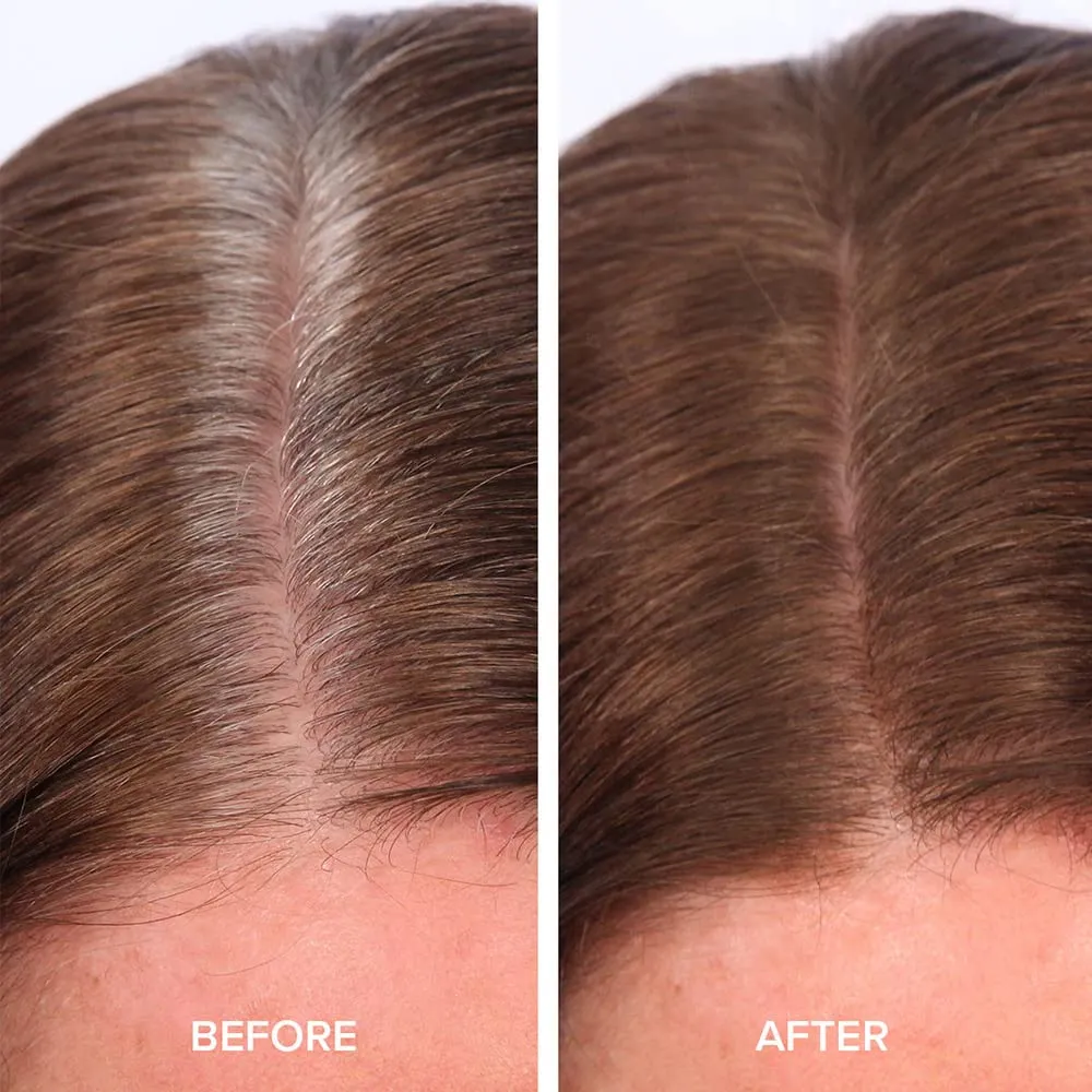 TRUHAIR Color & Conceal Waterproof Root Touch Up Hair Color Concealer - Hair Cover up for Gray Coverage and Hairline Filling - 11 Hair Colors Available (Medium Brown)